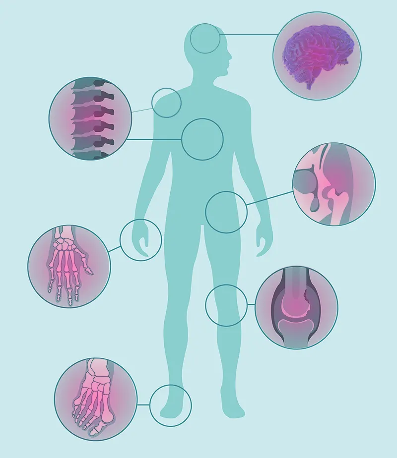 terapeuticenter-fisiatria-aree-del-dolore-SHS_1134623501
